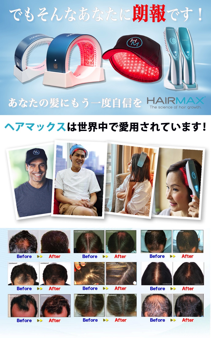 ヘアマックス【公式】気になったら始めるレーザー育毛HairMax